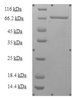 Human CCBL protein