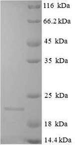 E.coli Conglutin-7 protein