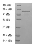 Mouse Adck2 protein