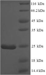 Mouse Nmes1 protein