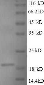 E.coli ssb protein