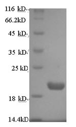 Human PRUNE protein
