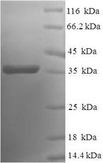 Human BCL2L2 protein