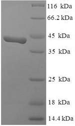 Human SMARCC1 protein