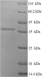 Human C9orf163 protein