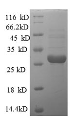 Human LSM10 protein