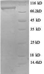 Human DDX27 protein