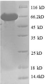 Human NR1H4 protein