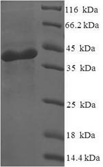 Human NMNAT3 protein