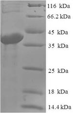 Human ABHD14B protein
