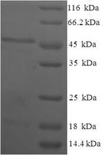 Human HSD17B11 protein