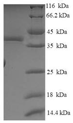 Human NABP1 protein