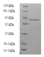 Human CHCHD4 protein