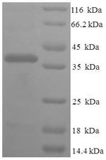 Human FIBIN protein
