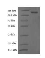 Human CNDP2 protein