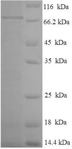 Human TEKT5 protein