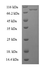 Human PNKP protein