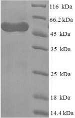 Human WDR77 protein