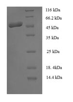 E.coli sspB protein