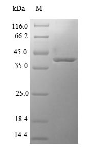 Human HSD17B10 protein