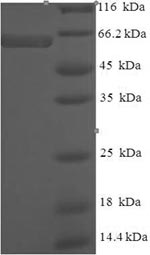 Human LMAN1L protein