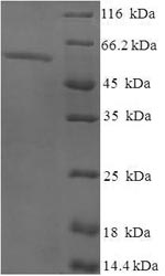 Human EXO5 protein