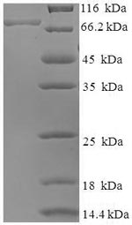 Mouse Bag3 protein