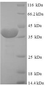 Human FKBP14 protein