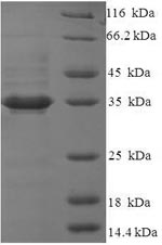 Human QPCTL protein