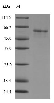 Human PDP2 protein