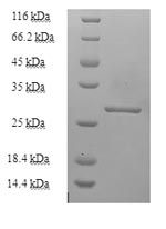 E.coli N14#1 protein