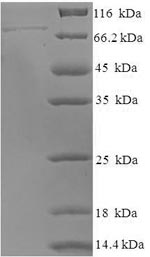 Human POLR3C protein