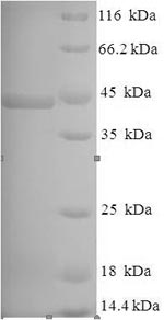 E.coli prpL protein
