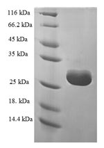 Human TRMT112 protein