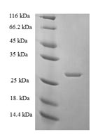 Human ZNRD1 protein