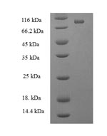 Human DDX19A protein