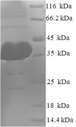 Human AGO2 Partial protein