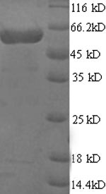 Human MINPP1 protein