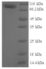 Human MTMR7 protein