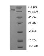 Human FARSA protein