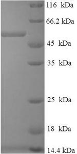 Human DHRS7 protein