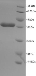 Human DLC1 protein