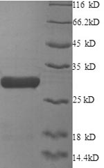 Human XRCC6 protein