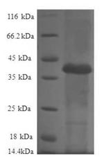 Human RPL36AL protein