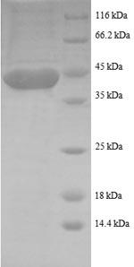 Human LMO1 protein