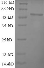 Human RPL15 protein