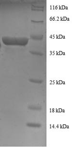 Human RPS16 protein
