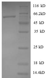 Human HNRPD protein