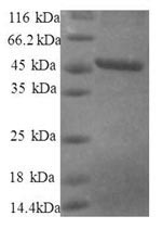 Human RPS10 protein