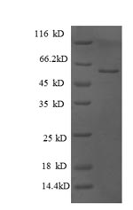 Human PRKCSH protein